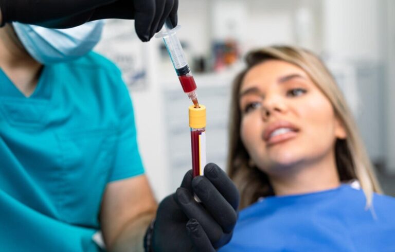 platelet rich fibrin
