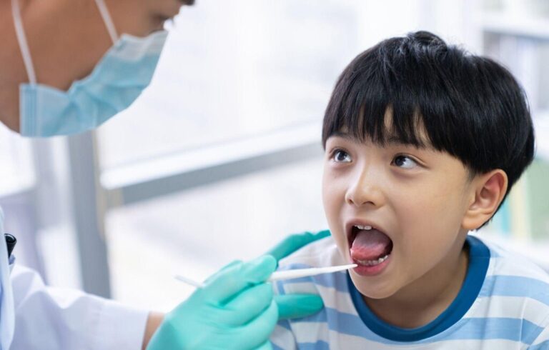 tongue tie surgery