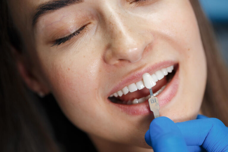 dental crown lengthening